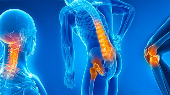 Arthrosis: Remedies against pain and inflamation